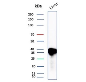 Apolipoprotein E Antibody Human Liver WB. Western blot testing of human liver tissue lysate with Apolipoprotein E antibody. A prominent band is detected at approximately 35 kDa, consistent with the predicted molecular weight range of Apolipoprotein E (34-37 kDa). The results demonstrate specific detection of this lipid transport protein, which plays a central role in cholesterol homeostasis and lipoprotein metabolism.
