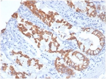 CK8 Antibody Dog Colon IHC. Immunohistochemical staining of FFPE dog colon tissue using CK8 Antibody (clone KRT8/4006) demonstrates strong membranous and cytoplasmic HRP-DAB brown staining within colonic epithelial cells lining glandular and mucosal structures. The staining pattern is consistent with expression of Cytokeratin 8 (CK8/KRT8), a type II intermediate filament protein widely expressed in simple epithelial tissues where it contributes to cytoskeletal organization, epithelial integrity, and cellular stress-response functions. CK8 immunoreactivity highlights epithelial architecture and glandular morphology within canine colon tissue, while surrounding stromal elements exhibit comparatively limited staining. HIER: boil tissue sections in pH 9 10 mM Tris with 1 mM EDTA for 20 minutes and allow to cool before testing.