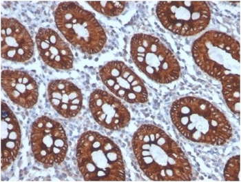 CK8 Antibody Human Colon Tissue IHC. Immunohistochemical staining of FFPE human colon tissue using CK8 Antibody (clone KRT8/4006) demonstrates strong membranous and cytoplasmic HRP-DAB brown staining throughout colonic epithelial cells lining well-defined glandular and crypt structures. The staining pattern is consistent with expression of Cytokeratin 8 (CK8/KRT8), a type II intermediate filament protein widely expressed in simple epithelial tissues where it contributes to cytoskeletal organization, epithelial integrity, and cellular stress-response pathways. CK8 immunoreactivity clearly highlights colonic epithelial architecture and glandular morphology, while surrounding stromal elements exhibit minimal staining. HIER: boil tissue sections in pH 9 10 mM Tris with 1 mM EDTA for 20 minutes and allow to cool before testing.