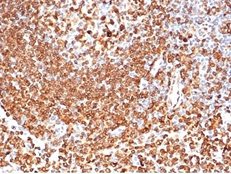 IHC staining of FFPE human lymph node tissue with CD74 antibody (clone CLIP/6609) at 2ug/ml. HIER: boil tissue sections in pH 9 10mM Tris with 1mM EDTA for 20 min and allow to cool before testing.