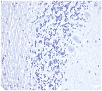 Negative control: IHC staining of FFPE human brain tissue with recombinant PSA antibody (clone KLK3/4602R) at 2ug/ml in PBS for 30min RT. HIER: boil tissue sections in pH 9 10mM Tris with 1mM EDTA for 20 min and allow to cool before testing.