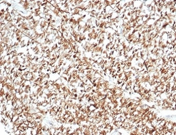 IHC staining of FFPE human brain tissue with Calbindin 2 antibody (clone CALB2/7029R). HIER: boil tissue sections in pH 9 10mM Tris with 1mM EDTA for 20 min and allow to cool before testing.