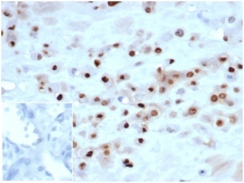 p57Kip2 Antibody Human Placenta Tissue IHC. Immunohistochemistry staining of FFPE human placenta tissue with recombinant p57Kip2 antibody (clone KIP2/7083R) at 2ug/ml in PBS for 30min RT. Negative control inset: PBS instead of primary antibody to control for secondary binding.
