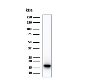 Western blot testing of human HepG2 cell lysate using CDKN2A antibody (clone CDKN2A/7081R). Predicted molecular weight ~16 kDa.