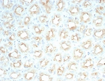 Cystic Fibrosis Transmembrane Regulator Antibody Salivary Gland IHC. Immunohistochemistry analysis of Cystic fibrosis transmembrane conductance regulator / CFTR expression in FFPE human salivary gland using recombinant rabbit monoclonal antibody clone CFTR/7154R. HRP-DAB brown staining is observed with apical membranous and luminal accentuation in ductal epithelial cells, while surrounding stromal cells show minimal signal; nuclei are counterstained blue. This CFTR antibody highlights epithelial ion channel localization consistent with secretory duct structures. Antigen retrieval was performed by boiling sections in 10 mM Tris buffer with 1 mM EDTA, pH 9, for 20 min followed by cooling at room temperature.