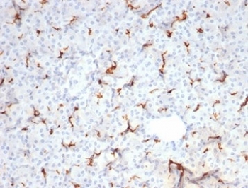 Cystic Fibrosis Transmembrane Regulator Antibody Spleen IHC. Immunohistochemistry analysis of Cystic fibrosis transmembrane conductance regulator / CFTR expression in FFPE human spleen tissue using recombinant rabbit monoclonal antibody clone CFTR/7154R. HRP-DAB brown staining is observed in scattered stromal and vascular-associated cells with membranous and cytoplasmic localization, while the majority of lymphoid cells show minimal signal; nuclei are counterstained blue. This CFTR antibody highlights limited expression consistent with non-epithelial tissue context. Antigen retrieval was performed by boiling sections in 10 mM Tris buffer with 1 mM EDTA, pH 9, for 20 min followed by cooling at room temperature.