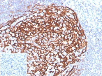 IHC staining of FFPE human tonsil tissue with CD21 antibody (clone CR2/3990R). Negative control inset: PBS instead of primary antibody to control for secondary binding. HIER: boil tissue sections in pH 9 10mM Tris with 1mM EDTA for 20 min and allow to cool before testing.