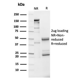 SDS-PAGE analysis of purified, BSA-free IGFBP3 antibody (clone IGFBP3/3517) as confirmation of integrity and purity.