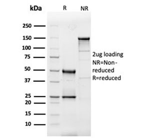 SDS-PAGE analysis of purified, BSA-free IL-3 antibody (clone IL3/4005) as confirmation of integrity and purity.