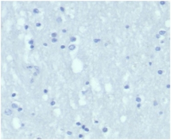 Negative control: IHC staining of FFPE human brain tissue with recombinant KRT7 antibody (clone KRT7/4387R) at 2ug/ml in PBS for 30min RT. HIER: boil tissue sections in pH 9 10mM Tris with 1mM EDTA for 20 min and allow to cool before testing.