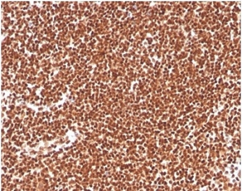 IHC staining of FFPE human colon tissue with RPA32 antibody (clone RPA2/4774). HIER: boil tissue sections in pH 9 10mM Tris with 1mM EDTA for 20 min and allow to cool before testing.
