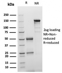 SDS-PAGE analysis of purified, BSA-free S100 beta/S100B antibody (clone S100B/4149) as confirmation of integrity and purity.