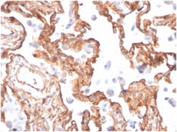 Immunohistochemistry of SPTAN1 antibody in human lung tissue. FFPE human lung shows cytoplasmic HRP-DAB brown staining along alveolar septa and within pneumocytes, consistent with Spectrin alpha chain, non-erythrocytic 1 localization along the submembranous cytoskeleton. Clone SPTAN1/3505 was used for detection and is Protein Microarray Validated. Heat-induced epitope retrieval was performed by boiling tissue sections in pH 9 10 mM Tris with 1 mM EDTA for 20 minutes followed by cooling prior to staining.