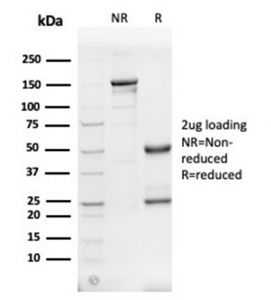 SDS-PAGE analysis of purified, BSA-free SPTAN1 antibody (clone SPTAN1/3505) as confirmation of integrity and purity.