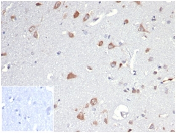 IHC staining of FFPE human brain tissue with Osteopontin antibody (clone OSP/4589). Negative control inset: PBS instead of primary antibody to control for secondary binding.