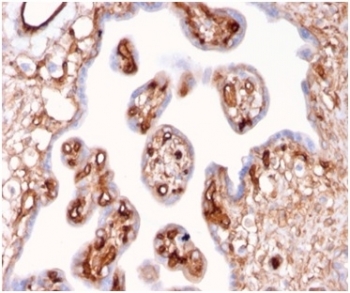 IHC staining of FFPE human placental tissue with Alpha II Spectrin antibody (clone SPTAN1/3507). HIER: boil tissue sections in pH 9 10mM Tris with 1mM EDTA for 20 min and allow to cool before testing.