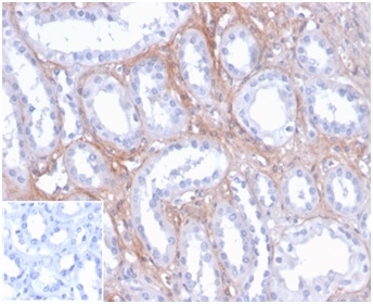 IHC staining of FFPE human kidney tissue with FGF-23 antibody (clone FGF23/4171) at 2ug/ml. Negative control inset: PBS instead of primary antibody to control for secondary binding. HIER: boil tissue sections in pH 9 10mM Tris with 1mM EDTA for 20 min and allow to cool before testing.