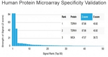 TDRKH Antibody Microarray Specificity Validation. Analysis of a protein microarray containing more than 19,000 full-length human proteins using TDRKH Antibody. The TDRKH Antibody shows top-ranked signal intensity for TDRKH with strong Z-score and S-score separation from other proteins, supporting highly specific target recognition and minimal cross-reactivity.