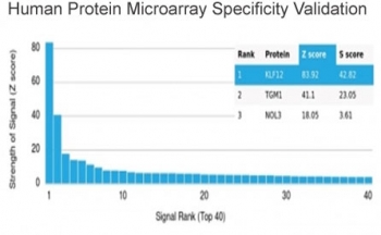 Analysis of HuProt(TM) microarray containing more than 19,000 full-length human proteins using KLF12 antibody (clone PCRP-KLF12-1E3). These results demonstrate the foremost specificity of the PCRP-KLF12-1E3 mAb. Z- and S- score: The Z-score represents the strength of a signal that an antibody (in combination with a fluorescently-tagged anti-IgG secondary Ab) produces when binding to a particular protein on the HuProt(TM) array. Z-scores are described in units of standard deviations (SD's) above the mean value of all signals generated on that array. If the targets on the HuProt(TM) are arranged in descending order of the Z-score, the S-score is the difference (also in units of SD's) between the Z-scores. The S-score therefore represents the relative target specificity of an Ab to its intended target.