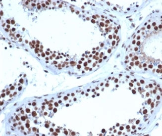 JAZF1 Antibody Testis IHC. Immunohistochemistry analysis of FFPE human testis tissue stained with JAZF1 Antibody / Transcriptional Regulation Protein clone PCRP-JAZF1-1C2 at 2 ug/ml following HIER in pH 9 Tris-EDTA buffer. Strong HRP-DAB brown nuclear staining is observed in seminiferous epithelial cell populations, consistent with expression of JAZF1 as a nuclear zinc finger protein involved in transcriptional regulation and chromatin-associated gene control pathways.