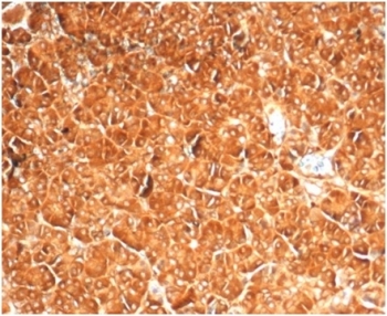 Vinculin Antibody Pancreas IHC. Immunohistochemistry staining of FFPE human pancreas with recombinant Vinculin antibody (clone VCL/7091R) at 2ug/ml. HIER: boil tissue sections in pH 9 10mM Tris with 1mM EDTA for 20 min and allow to cool before testing.