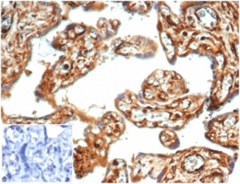 Vinculin Antibody Placenta IHC. Immunohistochemistry staining of FFPE human placental tissue with recombinant Vinculin antibody (clone VCL/7091R) at 2ug/ml. Negative control inset: PBS instead of primary antibody to control for secondary binding. HIER: boil tissue sections in pH 9 10mM Tris with 1mM EDTA for 20 min and allow to cool before testing.