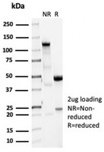 SDS-PAGE analysis of purified, BSA-free recombinant Vinculin antibody (clone VCL/7091R) as confirmation of integrity and purity.