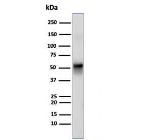 VIM Antibody / Cellular Stress Response Marker Antibody WB. Western blot analysis of human U-87 MG cell lysate using Vimentin antibody detects a band at approximately 55 kDa, consistent with the predicted molecular weight of Vimentin (VIM). The recombinant rabbit monoclonal clone rVIM/6914 shows a distinct band, supporting detection of intermediate filament components associated with stress-responsive cellular states. The presence of Vimentin in U-87 MG cells aligns with cytoskeletal organization linked to cellular stress adaptation and structural responses to environmental conditions.