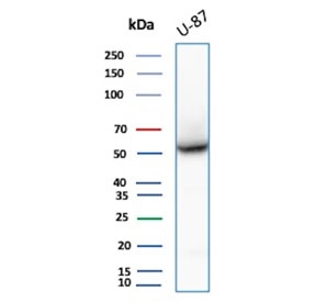 Western blot testing of human U-87 MG cell lysate using recombinant VIM antibody (clone rVIM/6914). Predicted molecular weight ~53 kDa.