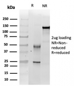 SDS-PAGE analysis of purified, BSA-free INI1 antibody (clone SMARCB1/3984) as confirmation of integrity and purity.