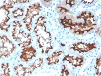 Angiotensin Converting Enzyme Antibody Kidney Tissue IHC. Immunohistochemistry analysis of FFPE human kidney tissue using Angiotensin Converting Enzyme Antibody (clone ACE/3764) shows strong membranous staining along renal tubular epithelial cells and vascular endothelium, consistent with ACE / CD143 localization as a cell surface enzyme. The staining outlines tubular structures and associated vascular elements, while interstitial regions display comparatively lower signal. Hematoxylin counterstain provides nuclear contrast and tissue architecture. Antibody incubation was performed at 2 ug/ml in PBS for 30 min at RT. HIER: boil FFPE tissue sections in pH 9 10 mM Tris with 1 mM EDTA for 20 min and allow to cool before testing.