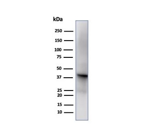 Western blot testing of human liver tissue using Glutamine Synthetase Antibody GLUL/6599. Predicted molecular weight ~42 kDa.