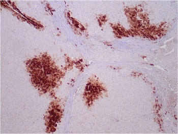 Immunohistochemistry of Glutamine Synthetase Antibody GLUL/6599 in human liver tissue. Formalin-fixed, paraffin-embedded human liver sections demonstrate strong cytoplasmic HRP-DAB brown staining in pericentral hepatocytes surrounding central veins, consistent with the characteristic zonal expression pattern of Glutamate-ammonia ligase (GLUL). Periportal hepatocytes show comparatively weaker staining. The antibody was applied at 2 ug/ml. Heat-induced epitope retrieval was performed by boiling tissue sections in pH 9 10 mM Tris with 1 mM EDTA for 20 min followed by cooling prior to antibody incubation.
