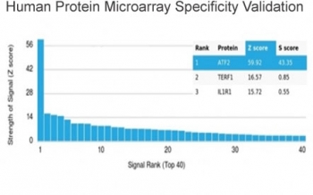 Analysis of HuProt(TM) microarray containing more than 19,000 full-length human proteins using ATF2 antibody (clone PCRP-ATF2-1B4). These results demonstrate the foremost specificity of the PCRP-ATF2-1B4 mAb. Z- and S- score: The Z-score represents the strength of a signal that an antibody (in combination with a fluorescently-tagged anti-IgG secondary Ab) produces when binding to a particular protein on the HuProt(TM) array. Z-scores are described in units of standard deviations (SD's) above the mean value of all signals generated on that array. If the targets on the HuProt(TM) are arranged in descending order of the Z-score, the S-score is the difference (also in units of SD's) between the Z-scores. The S-score therefore represents the relative target specificity of an Ab to its intended target.