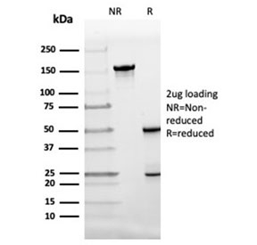 SDS-PAGE analysis of purified, BSA-free FABP4 antibody (clone FABP4/4424) as confirmation of integrity and purity.