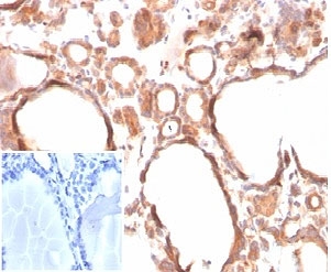 IHC staining of FFPE human thyroid tissue with Calcitonin antibody (clone CALCA/3310). Negative control insert: PBS used in place of primary antibody. HIER: boil tissue sections in pH 9 10mM Tris with 1mM EDTA for 20 min and allow to cool before testing.