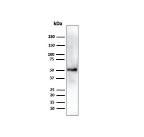 Aldehyde Dehydrogenase 1A1 Antibody HepG2 Cell WB. Western blot testing of human HEPG-2 cell lysate using Aldehyde Dehydrogenase 1A1 antibody (clone ALDH1A1/4793). Expected molecular weight ~55 kDa.