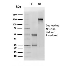 SDS-PAGE analysis of purified, BSA-free Aldehyde Dehydrogenase 1A1 antibody (clone ALDH1A1/4793) as confirmation of integrity and purity.