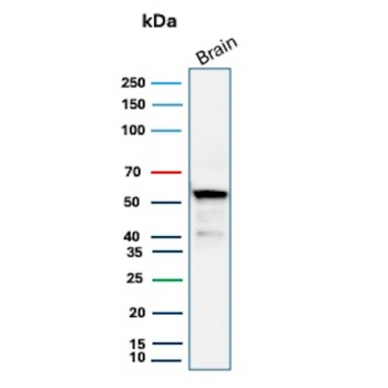Aldehyde Dehydrogenase 1A1 Antibody Brain WB. Western blot testing of human brain tissue lysate using Aldehyde Dehydrogenase 1A1 antibody (clone ALDH1A1/4793). Expected molecular weight ~55 kDa.