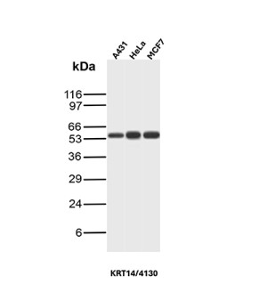 Western blot analysis of human A431, HeLa and MCF-7 cell lysates using CK14 Antibody KRT14/4130.