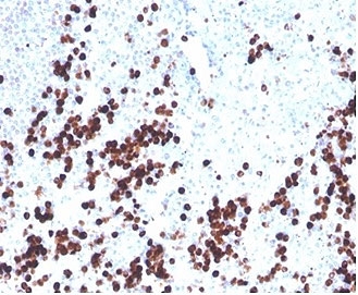 IHC staining of FFPE human spleen tissue with Lysozyme C antibody (clone LYZ/3943). HIER: boil tissue sections in pH 9 10mM Tris with 1mM EDTA for 20 min and allow to cool before testing.