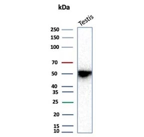 INHA Antibody Recombinant Mouse MAb rINHA/6919 western blot analysis. Western blot testing of human testis tissue lysate using INHA Antibody Recombinant Mouse MAb rINHA/6919. A band is detected at approximately 40 kDa, consistent with the predicted molecular weight of Inhibin subunit alpha (INHA).