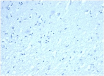 Negative control: IHC staining of FFPE human brain tissue using recombinant INHA antibody (clone rINHA/6919at 2ug/ml in PBS for 30min RT. HIER: boil tissue sections in pH 9 10mM Tris with 1mM EDTA for 20 min and allow to cool before testing.