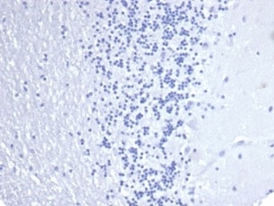 Negative control: IHC staining of FFPE human brain tissue using Keratin 14 antibody (clone KRT14/4584R) at 2ug/ml in PBS for 30min RT. HIER: boil tissue sections in pH 9 10mM Tris with 1mM EDTA for 20 min and allow to cool before testing.