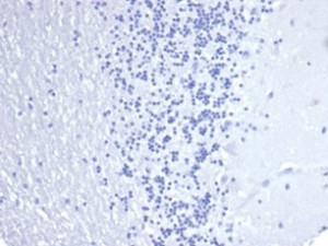 Negative control: IHC staining of FFPE human brain tissue using Keratin 14 antibody (clone KRT14/4584R) at 2ug/ml in PBS for 30min RT. HIER: boil tissue sections in pH 9 10mM Tris with 1mM EDTA for 20 min and allow to cool before testing.