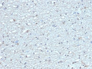 IHC staining of FFPE human brain tissue with LEPR antibody (clone LEPR/4304). HIER: boil tissue sections in pH 9 10mM Tris with 1mM EDTA for 20 min and allow to cool before testing.