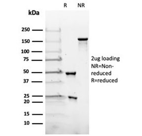 SDS-PAGE analysis of purified, BSA-free LH beta antibody (clone rLHb/1613) as confirmation of integrity and purity.