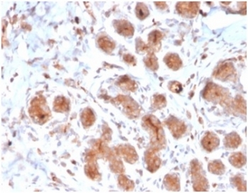 IHC staining of FFPE human breast tissue with LTF antibody (clone LTF/4073). HIER: boil tissue sections in pH 9 10mM Tris with 1mM EDTA for 20 min and allow to cool before testing.