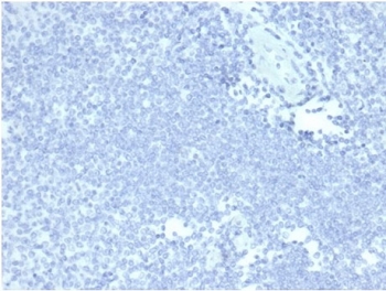 Negative control: IHC staining of FFPE human tonsil tissue with recombinant MUC5AC antibody (MUC5AC/7068R) at 2ug/ml in PBS for 30min RT. HIER: boil tissue sections in pH 9 10mM Tris with 1mM EDTA for 20 min and allow to cool before testing.