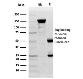 SDS-PAGE analysis of purified, BSA-free Lysozyme C antibody (clone LYZ/3944) as confirmation of integrity and purity.